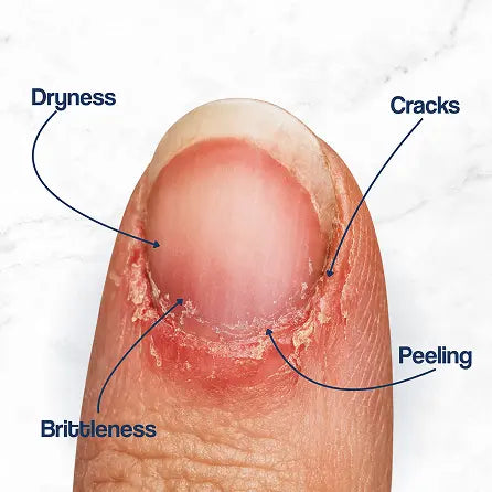 Cuticle Care+ Cuticle Oil with HydraLock System