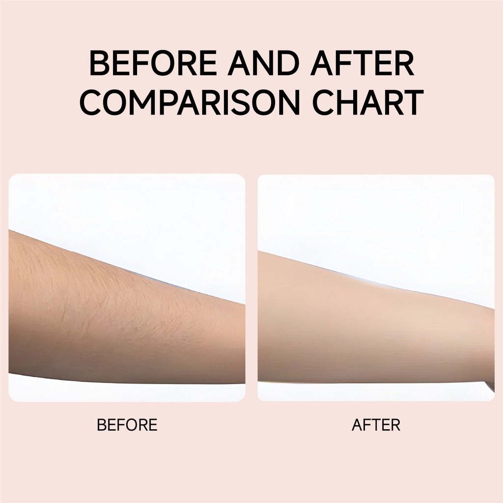 Sonic szőrtelenítő 