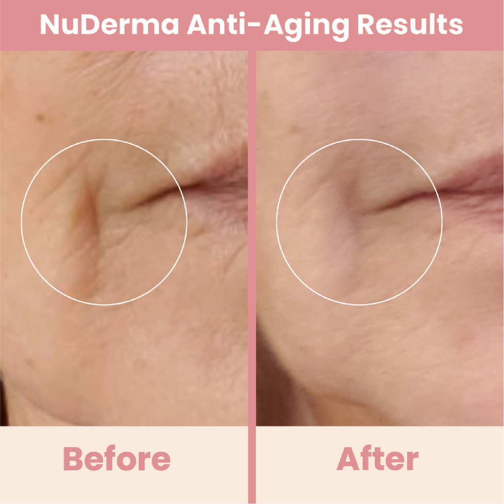 Clinical High Frequency Wand