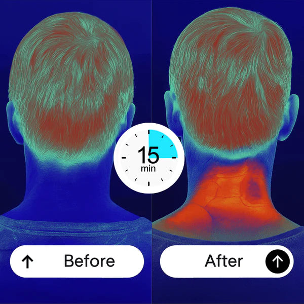 Cervical vagus nerve stimulator