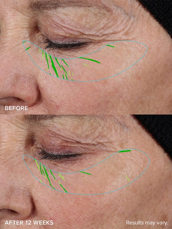 Needle-less® Growth Factor Serum