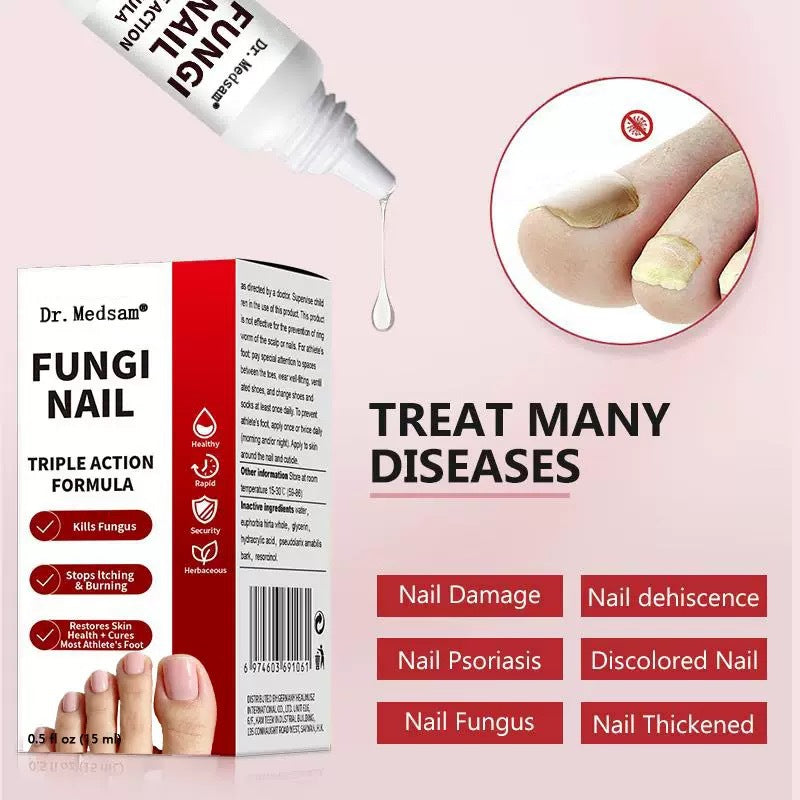 FUNGAL NAIL antibacterial nail care solution improves hangnails and nourishes cuticles.