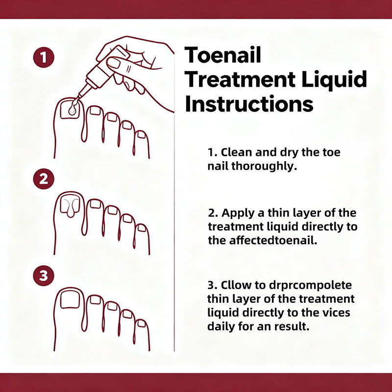 FUNGAL NAIL antibacterial nail care solution improves hangnails and nourishes cuticles.